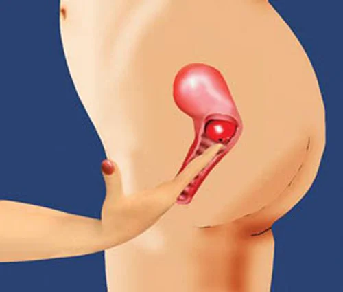 Cổ tử cung: Những điều bác sĩ muốn mẹ biết